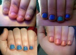 Bitten Nails Grown Using Gelish Gel Polish Over 7 Weeks Nails How To Grow Nails Gel Nails Diy Nail extensions on bitten nails how to apply gel nails on bitten nails.