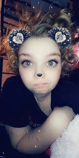 Hair loss solutions for epilepsy medication?