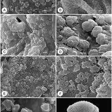 Image result for Bertiera angusiana