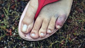 Check spelling or type a new query. Pies Feos Unas Largas Nail Art