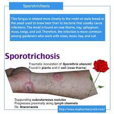 Sporotrichosis is a disease caused by the infection of the fungus sporothrix schenckii. Pharmacy Medications Health Blog Twitterren Sporotrichosis Also Known As Rose Gardener S Disease Is A Rare Infection Caused By A Fungus Called Sporothrix Tuesdaythoughts Healthcare Pharmacy Rosegardener Fungus Infectiousdiseases Cvs