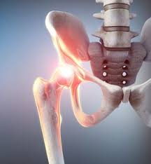 Schambeinarthrose Symphysenarthrose