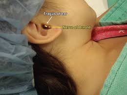 Image result for Ear Nerve Block