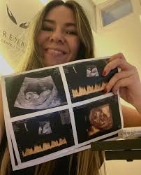 Drenaje Linfático ~ Masajes ~ Limpieza facial (@drenamiconcept) · Instagram  照片和视频