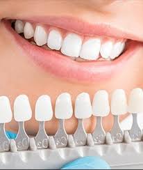 Cosmetic Dentistry Round Rock Teeth Whitening Porcelain