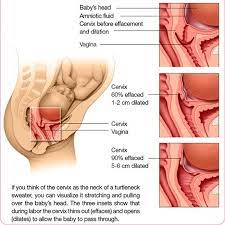 Moms who've had a baby before may be dilated for weeks. Facebook