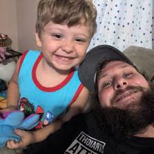 What issues can occur when leaving the heat shields off a Can-Am Renegade  or Outlander unit?