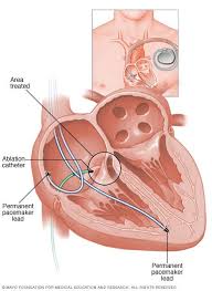 Pin On Heart