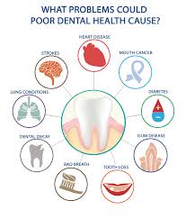 Research Has Shown That Infections In The Mouth May Be Associated With Heart Disease Stroke In 2020 Dental Health Oral Health Education Dental Surgery