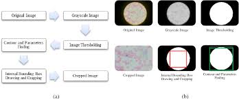 Figure 4 From Mobile Based Automated Complete Blood Count