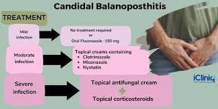 Image result for balanoposthitis