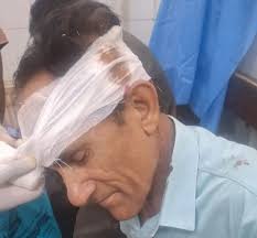 Senior photojournalist Amin War injured in accident