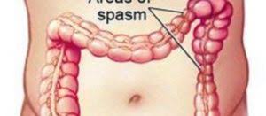 Alimenti fritti come le patatine, il pollo e in generale tutti quegli alimenti che vengono fritti con molto olio sono rischiosi per la salute, specialmente se soffrite di colon irritabile. Colon Colon Irritabile Sindrome Del Colon Irritabile Colite Dieta Colon Irritabile Diete Intestino Irritato Alimentazione Colon Irritabile Colon Retto Infiammazione Del Colon Infiammazione Intestino Terapia Diagnosi Farmaco Rimedi Terapie Farmaci