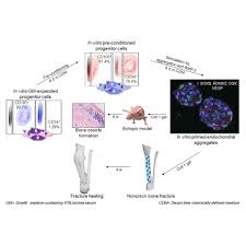 Can you pick the anatomy of a long bone? Healing Of A Large Long Bone Defect Through Serum Free In Vitro Priming Of Human Periosteum Derived Cells Sciencedirect