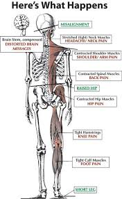 Pin On Backpain Remedies