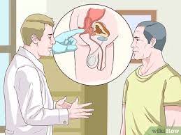 How To Self Screen For Colon Cancer: 9 Steps (With Pictures)