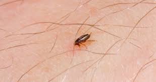 Check spelling or type a new query. Do Fleas Fly Getridofallthings Com