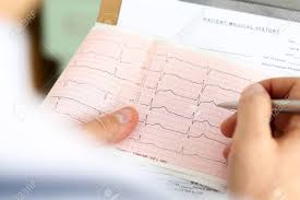 Male Medicine Doctor Hands Holding Cardiogram Chart On Clipboard