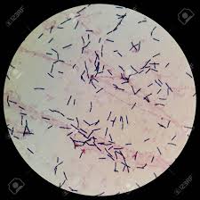 Check spelling or type a new query. Smear Of Gram S Stained With Gram Positive Bacilli Bacteria Stock Photo Picture And Royalty Free Image Image 78421842