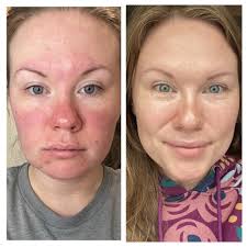 Riman skincare for hydrated, dewy skin