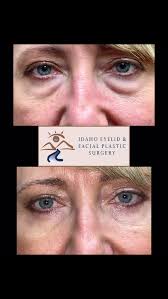 MarkBoernerMD/ChadJacksonMD