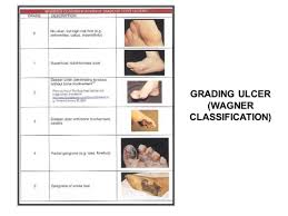 Image result for Wagner Ulcer Classification