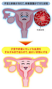 卵巣 嚢腫 消え た