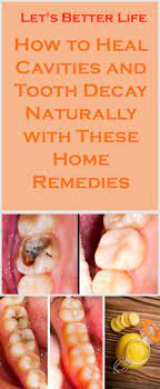 Many home remedies can prevent cavities or stop them at a very early stage. How To Heal Cavities Naturally At Home Arxiusarquitectura