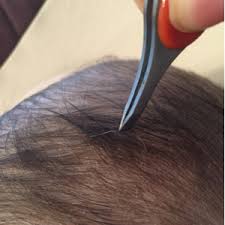 Lamb, md, from mount dr. Gray Hair March 2015 Babies Forums What To Expect