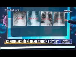Akcigerler Nasil Temizlenir Youtube