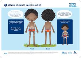 Changing Diabetes In Children Dialogue Poster 11 A Pdf Version Of These Patient Education Materials Are Diabetes In Children Patient Education Diabetes