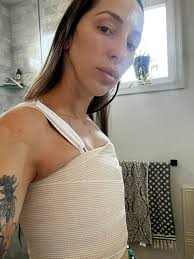 Just explanted!! (Saline) Capsulectomy and lift with Dr. Buinewicz, and he  was Amazing.. (Doylestown, PA)Drove over 2 hours but totally worth it. I  can't say enough good things about him and all