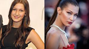 Corrige tus orejas con la otoplastia solo en @reduxclinica. Que Es La Bichectomia El Ultimo Capricho Beauty De Las Celebrities Infobae
