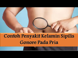 Untuk konsultasi dan pemesanan obat sipilis dan obat kencing nanah serta berbagai obat herbal lainya dari de nature indonesia hubungi kami di tlp/sms/whatsapp: Contoh Penyakit Kelamin Sipilis Gonore Pada Pria Youtube