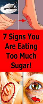 7 Signs You Are Eating Too Much Sugar Worlds News Ate Too Much Natural Health Tips Health And Fitness Tips