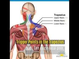 Attached to the bones of the skeletal system are about 700 named muscles that make up roughly half of a person's body weight. Trigger Point Acupuncture For Upper Back Pain Morningside Acupuncture Youtube