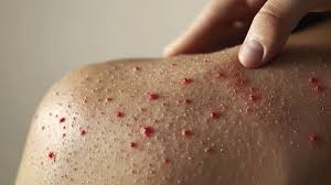 images?q=tbn:ANd9GcTYSBzMJbNLSZyHzgS5Dp_FZSEGWBk39_JQyQ&s