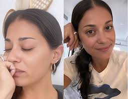 Loren's Body Dysmorphia and Plastic Surgery Obsession