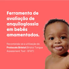 👶🏽 #TestedaLinguinha O teste da linguinha é essencial para identificar  possíveis problemas de amamentação. Trata-se de um exame simples realizado  em recém-nascidos para verificar a presença de anquiloglossia (língua  presa). Essa condição