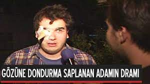 Gozune Dondurma Saplanan Adamin Drami Youtube