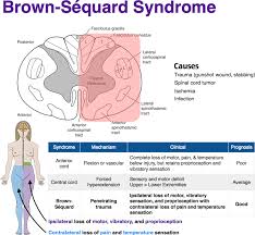 Rosh Review Medical Knowledge Medical Terminology Study Nervous System Anatomy