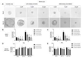 Valid from now until 31 march. Cells Free Full Text Effect Of Reducing Ataxia Telangiectasia Mutated Atm In Experimental Autosomal Dominant Polycystic Kidney Disease Html