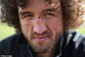 Namibia captain Jacques Burger chasing World Cup win for last time as 60  injuries in two years force retirement