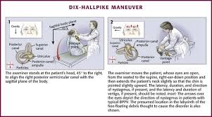 Image result for Oculovestibular Testing