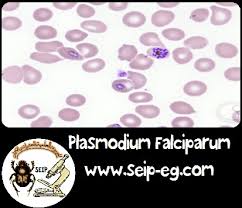 ويتمثل الهدف الأول من العلاج في ضمان التخلص السريع والتام من طفيل المتصورة في دم المريض لمنع تقدم الملاريا غير المصحوبة. Ø§Ù„Ù…Ù„Ø§Ø±ÙŠØ§ Ù†Ø¸Ø±Ø© Ø¹Ø§Ù…Ø© Malaria