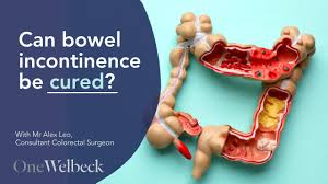 Image result for Fecal Incontinence