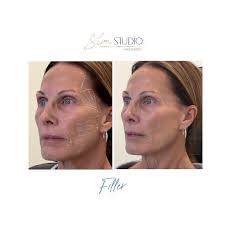 🎉 Congratulations to our two Holiday Sip & Stroll Winners! 🎉 A big round  of applause for Amber Dicks, who won the EmSculpt NEO series of four, and  Ann McCurdy, who snagged