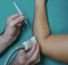 Image result for Elbow Injection