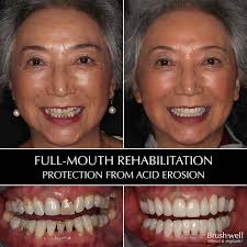 Dental Implants, Orthodontics, Wisdom Teeth & More