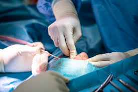 De asemenea, pentru o recuperare optima. Operatia De Deviatie De Sept Nazal Medlife